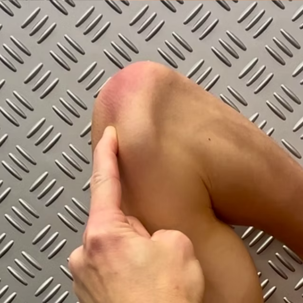 Elbow Pain (Posterior), illustration