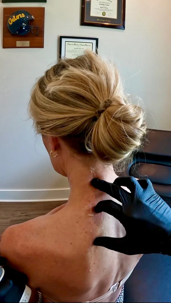 Physical exam of neck and shoulder pain before ultrasound-guided fascia injection at Mississippi Motion