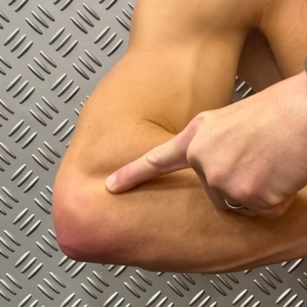 Elbow Pain (Lateral) | Mississippi Motion