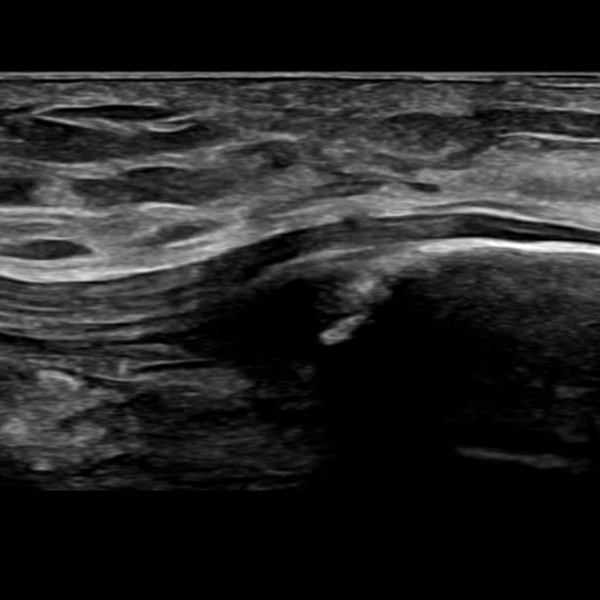 Ultrasound Exams | Mississippi Motion