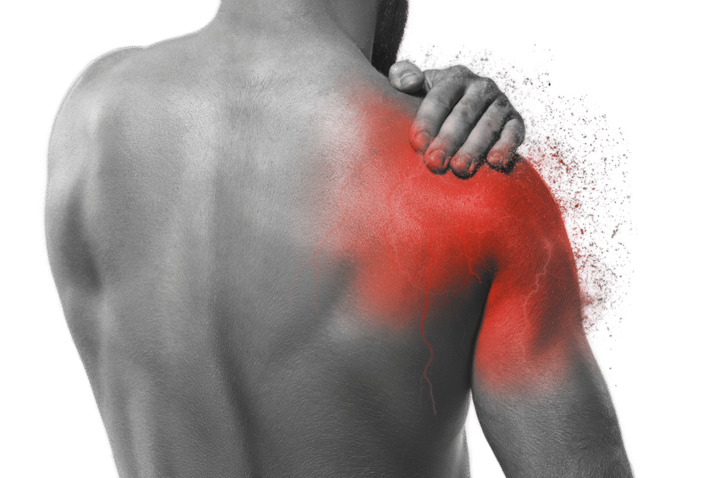 Mississippi Motion | Shoulder Pain